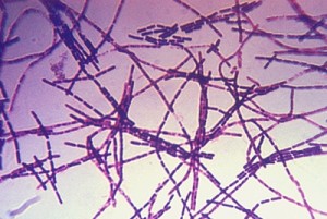 A photomicrograph of Bacillus anthracis bacteria using Gram stain technique.Anthrax is diagnosed by isolating B. anthracis from the blood, skin lesions, or respiratory secretions or by measuring specific antibodies in the blood of persons with suspected cases.