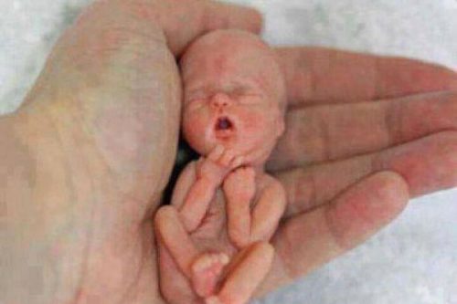 abortus-