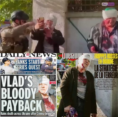Кијев режирао нову ,,драму“: Глумци пред камерама западних и украјинских медија у улози ,,рањених“ и ,,крвавих“ жртава