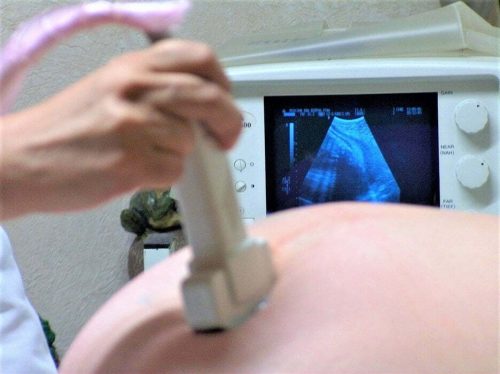 ultrazvuk-trudnica