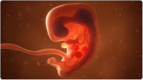 abortus-fetus